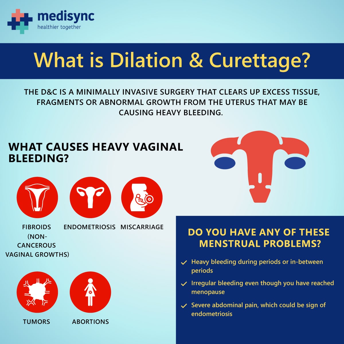 Leading hospitals for Dilation & curettage surgery in Hyderabad | Call ...